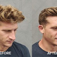 Focal Point Technique with Feather Nape and Body Razor - David Reinhold - Before and After