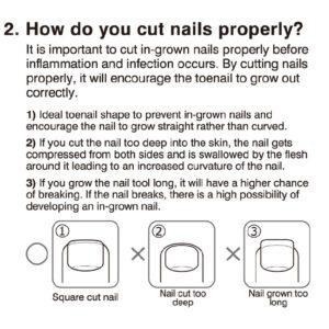 Seki Edge In-Grown Toenail Nipper (SS-203) how to cut nails properly