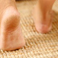 How to get Rid of Calluses and Corns: Treatment and Prevention