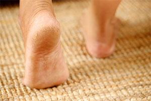 How to get Rid of Calluses and Corns: Treatment and Prevention